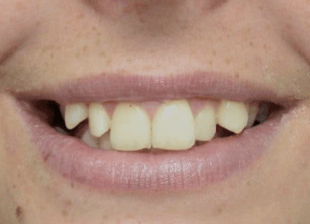 Original -smile-diffrence