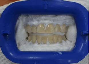Original -smile-diffrence