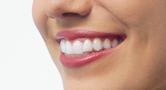 Clear-Smile