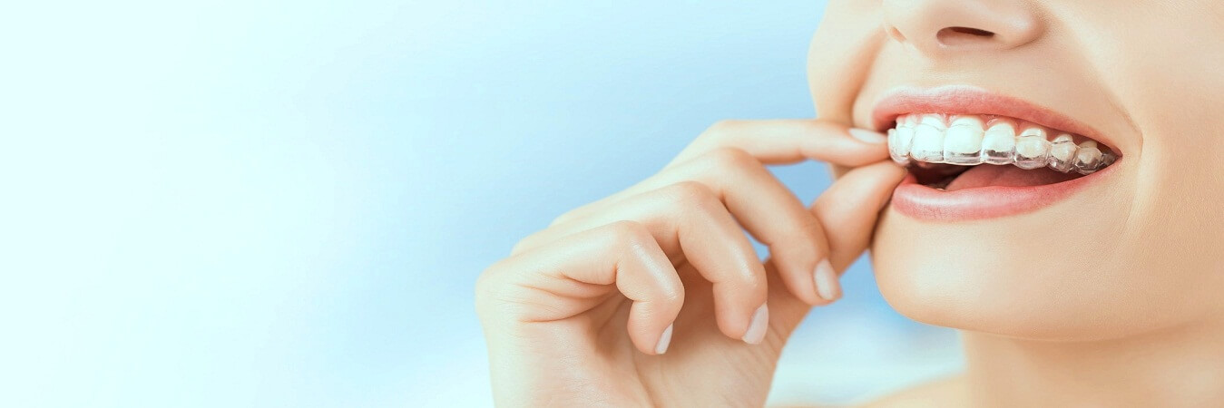 invisalign-background