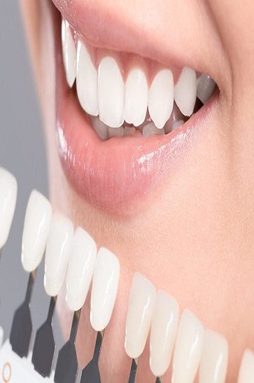 Cosmetic Dentistry